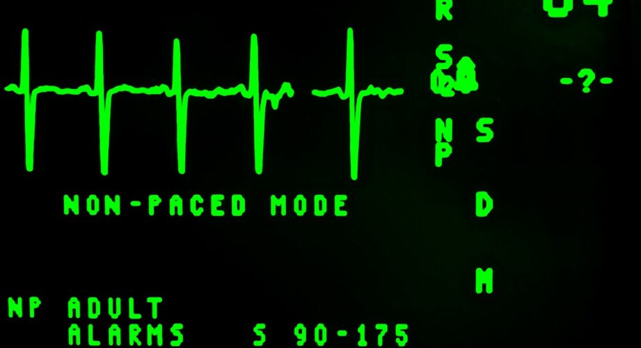 electrocardiogram