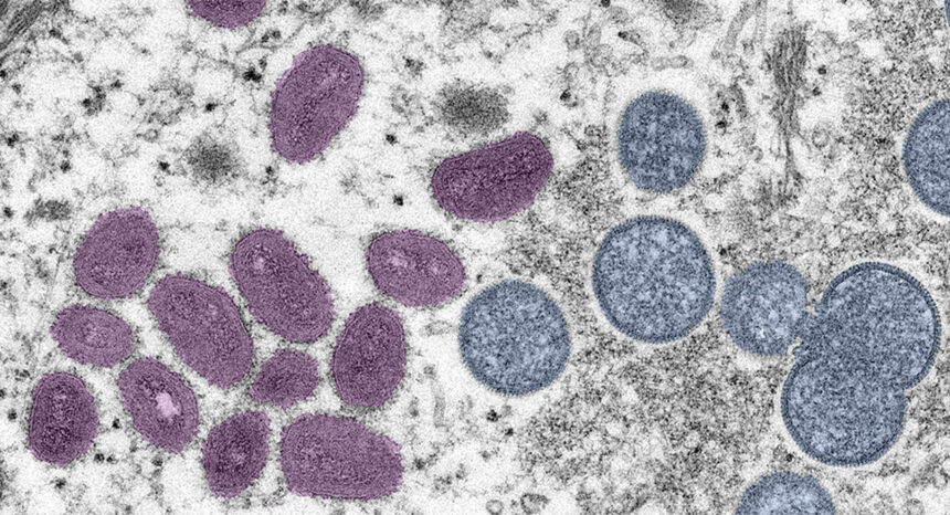 Monkeypox virus image